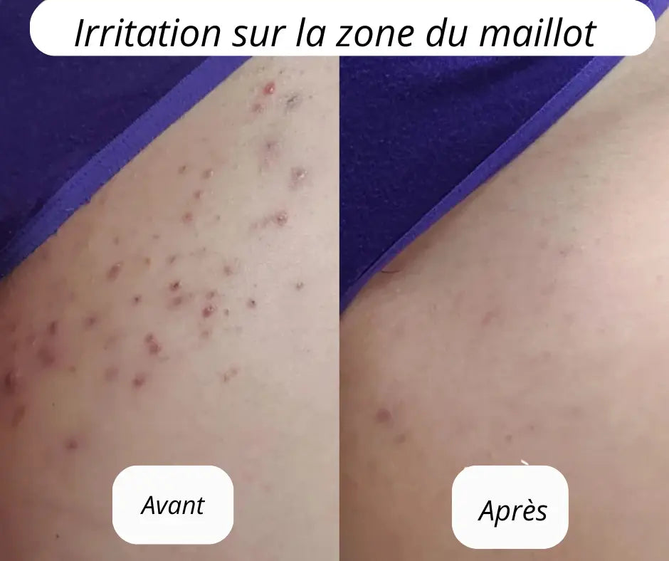 NOVASHAVE: Epilateur 2 en 1