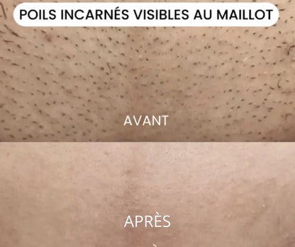 NOVASHAVE: Epilateur 2 en 1